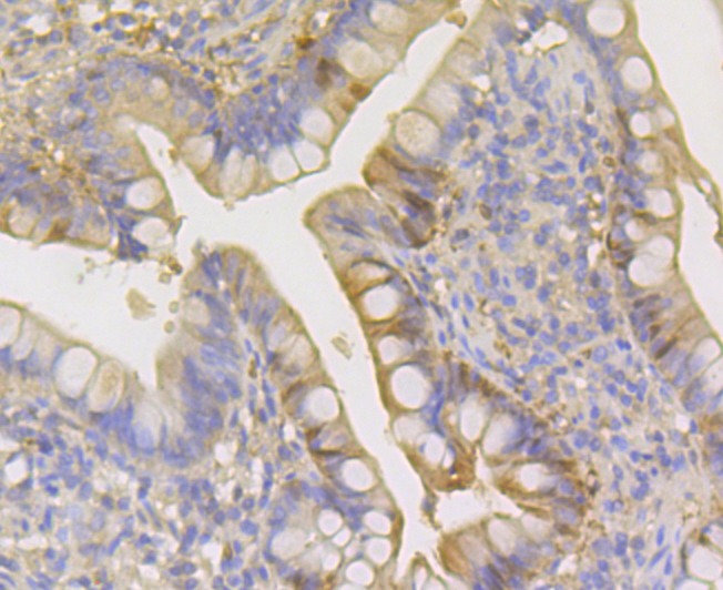 Anti-Carbonic Anhydrase 1 Antibody (2E643)