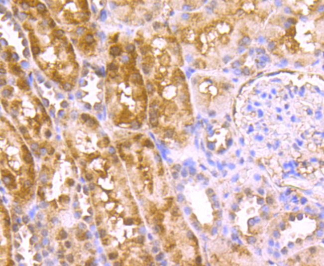 Anti-C12orf51 Antibody (8V885)