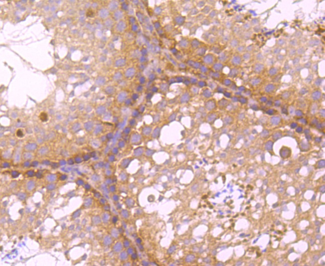 Anti-C12orf51 Antibody (8V885)