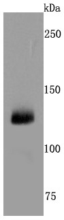 Anti-CD41 Antibody (5U824)