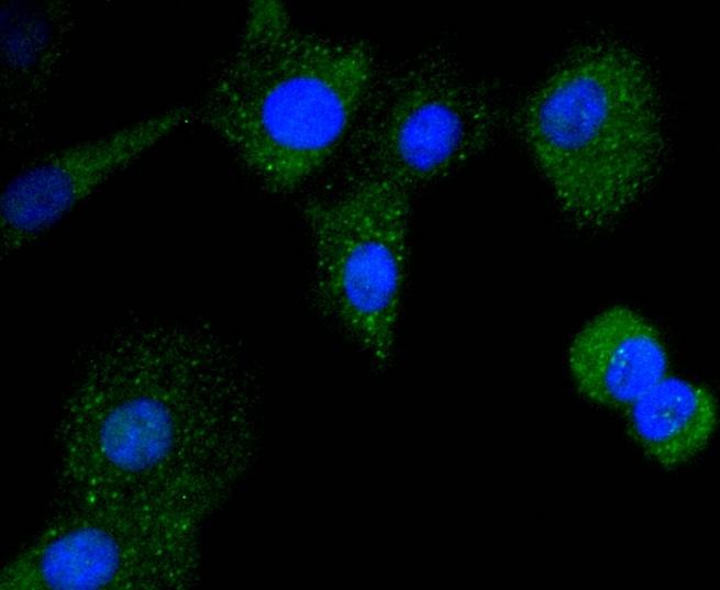 Anti-CD21 Antibody (2Z920)
