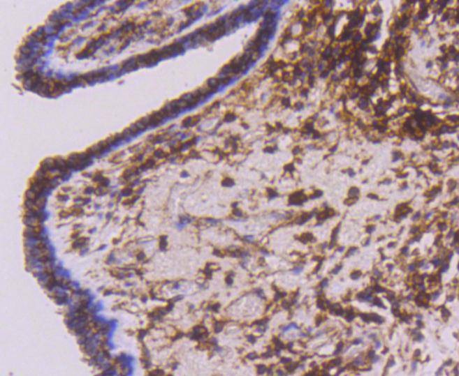 Anti-CD44 Antibody (5M235)
