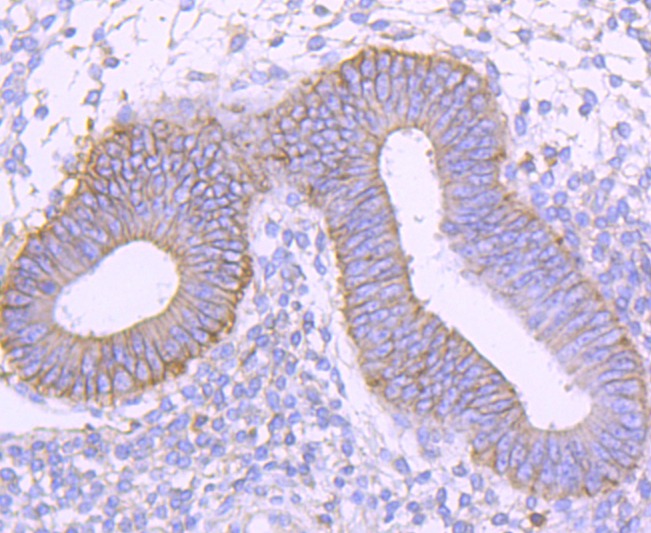 Anti-CD99 Antibody (5Q457)
