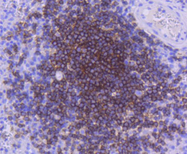 Anti-CD21 Antibody (2Z920)