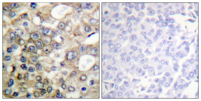 Anti-Phospho-Mucin-1/MUC1 (Tyr1229) Polyclonal Antibody 2