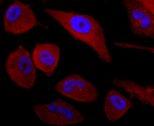 Anti-CD99 Antibody (5Q457)