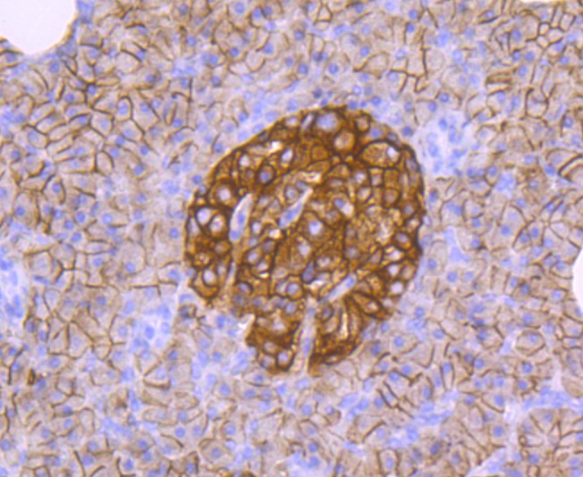 Anti-CD99 Antibody (5Q457)
