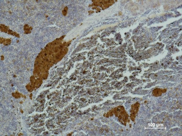 Anti-CD25/IL2R alpha Antibody (8I39)