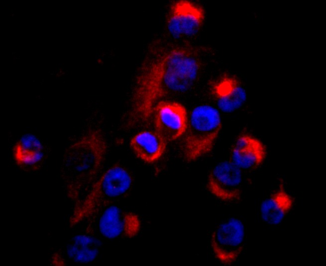 Anti-CD99 Antibody (5Q457)