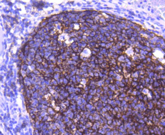 Anti-CD21 Antibody (2Z920)