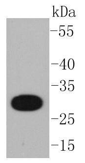 Anti-CD20 Antibody (9T986)