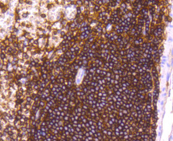 Anti-CD44 Antibody (5M235)