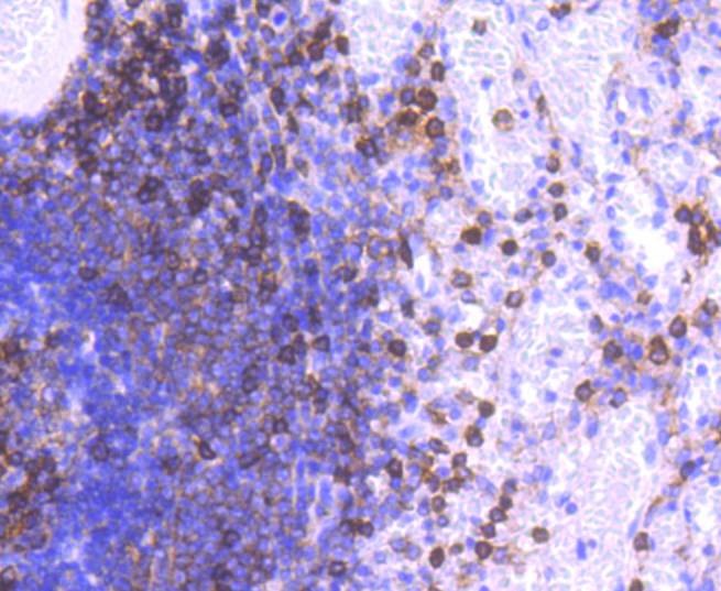 Anti-ITGAL Antibody (1J385)