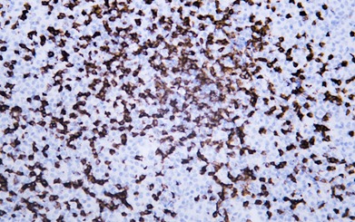 Anti-CD8 alpha Antibody (2N656)