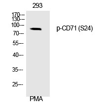 Anti-Phospho-Transferrin Receptor/TFRC (Ser24) Polyclonal Antibody