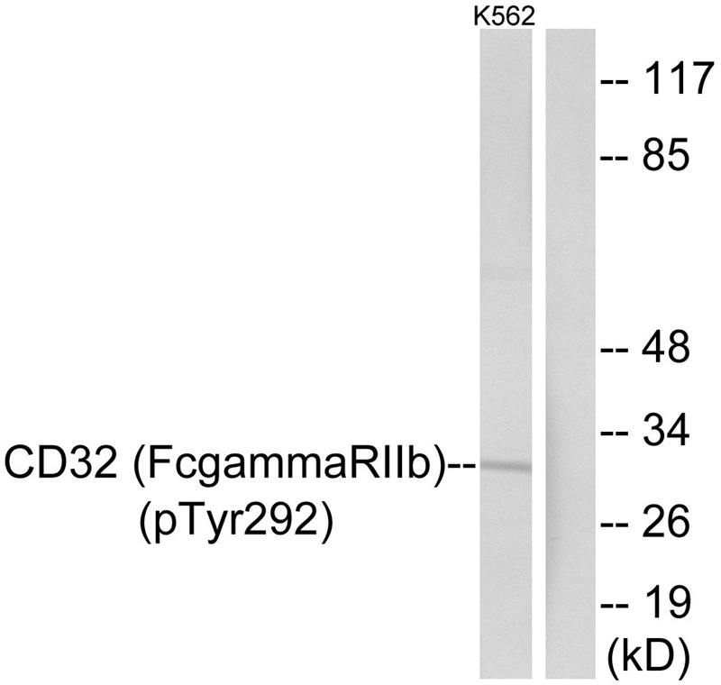 Anti-Phospho-CD32B/Fcgr2b (Tyr292) Polyclonal Antibody