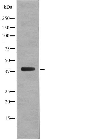 Anti-Phospho-C5AR1 (Ser327) Polyclonal Antibody