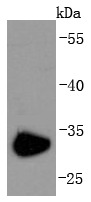 Anti-CD74 Antibody (9A482)
