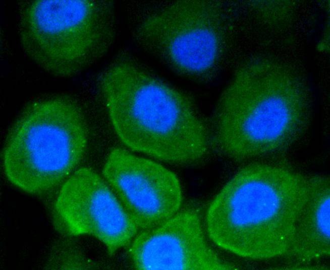 Anti-CD86 Antibody (5O340)
