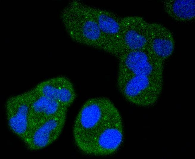 Anti-ITGAL Antibody (1J385)
