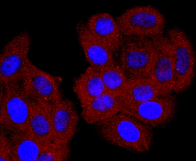 Anti-CD74 Antibody (9A482)