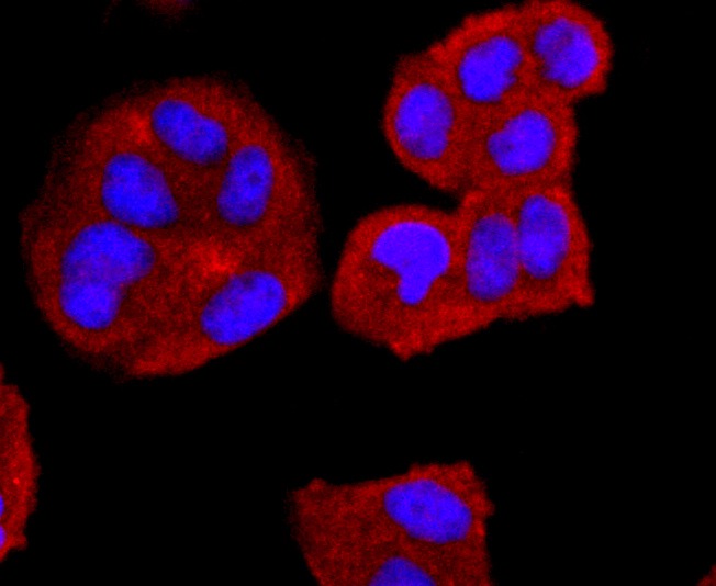 Anti-CD74 Antibody (9A482)