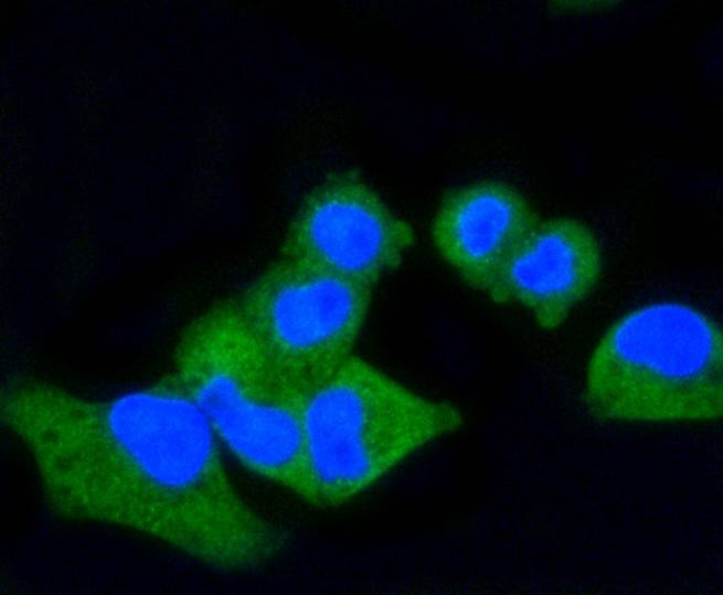 Anti-CD86 Antibody (5O340)