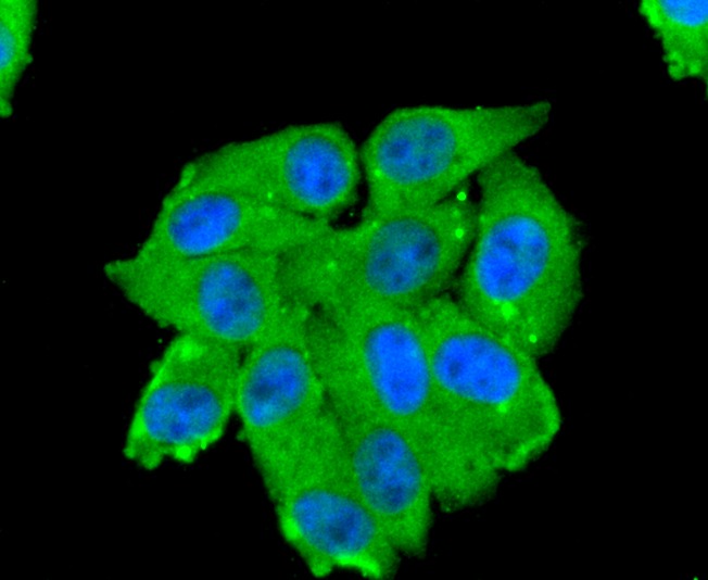 Anti-Aminopeptidase N/CD13 Antibody (3J107)