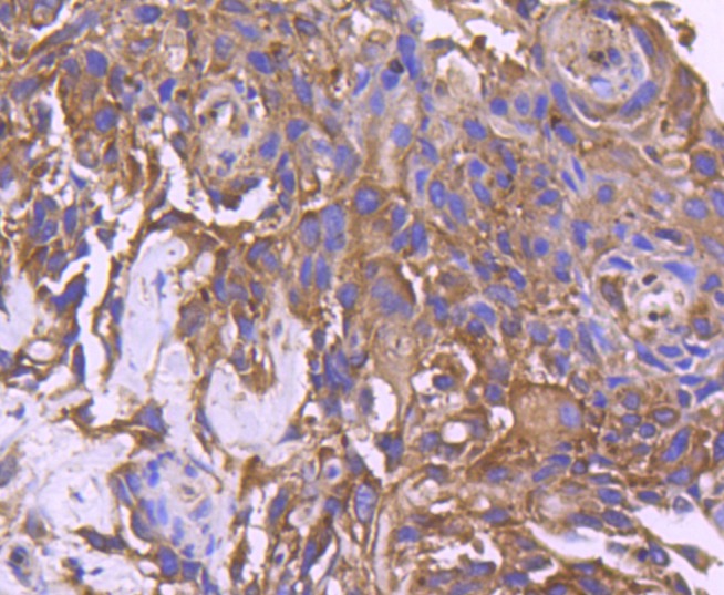 Anti-Neprilysin/CD10 Antibody (5M454)