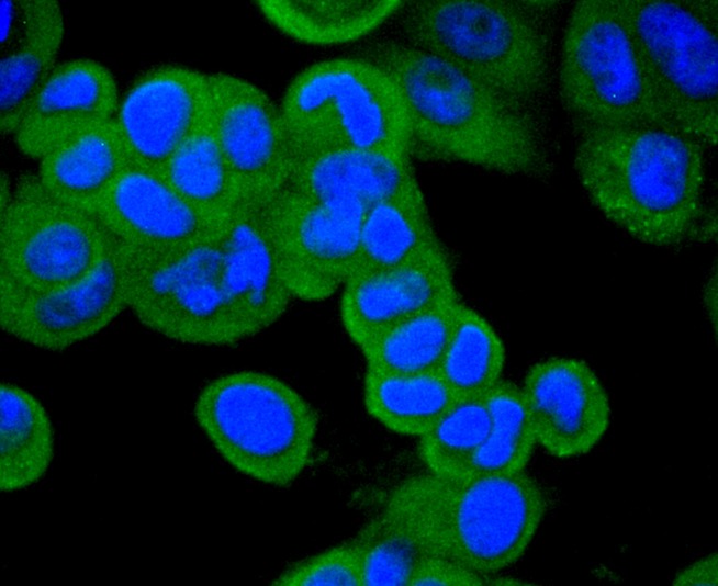 Anti-Neprilysin/CD10 Antibody (5M454)