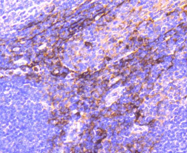 Anti-Aminopeptidase N/CD13 Antibody (3U499)