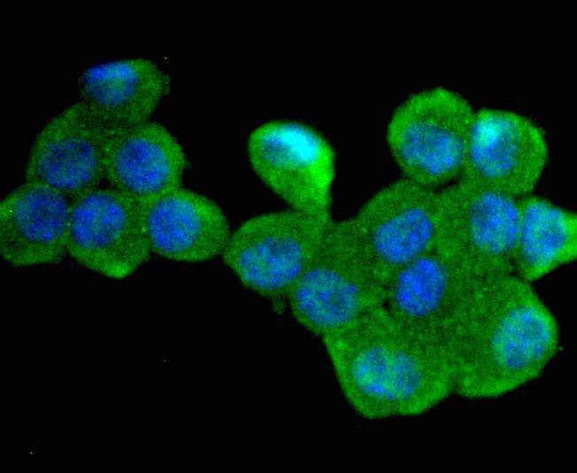 Anti-CDC34 Antibody (7P182)