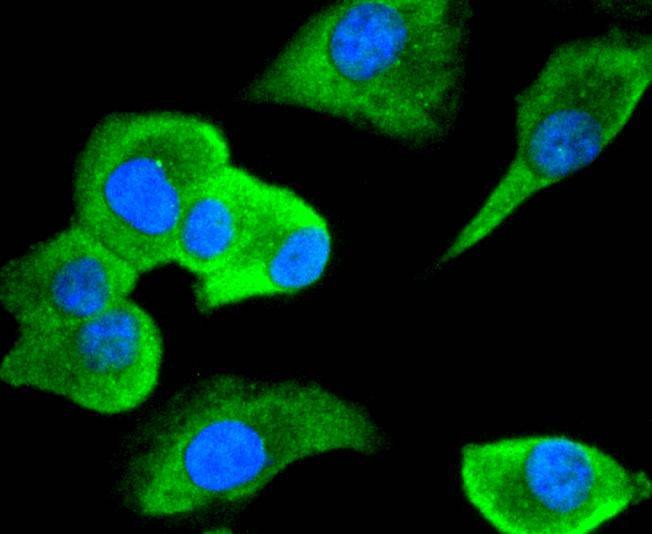 Anti-CDC34 Antibody (7P182)