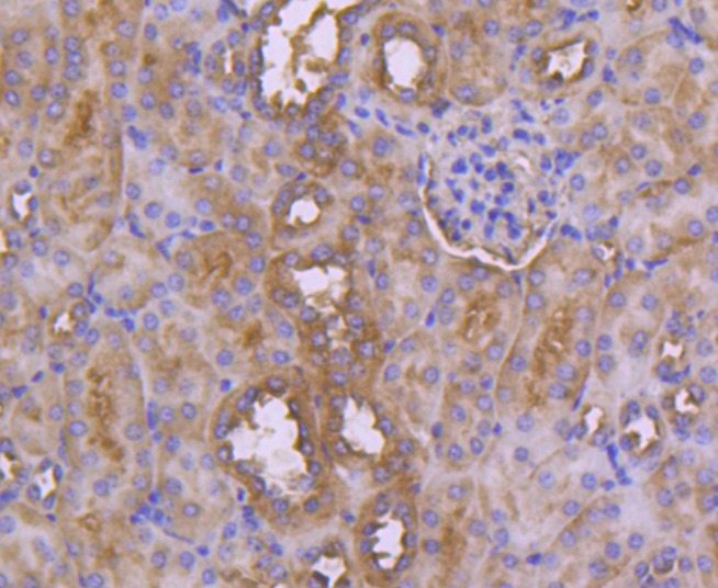 Anti-Neprilysin/CD10 Antibody (5M454)