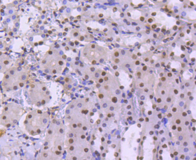 Anti-SMARCA4 Antibody (3I277)