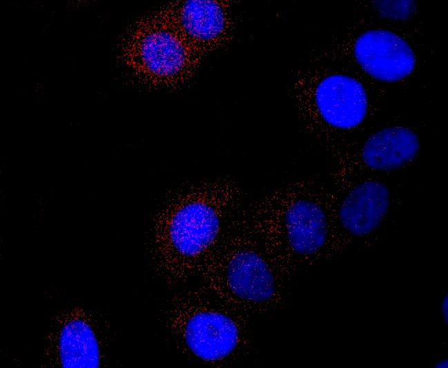 Anti-CTSL Antibody (9O318)