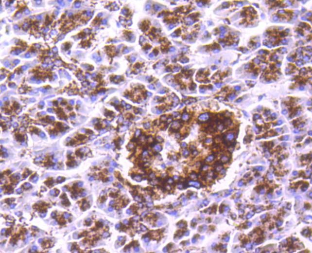 Anti-Cathepsin D Antibody (4I539)
