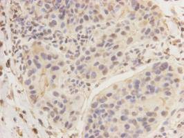Anti-Breast cancer-overexpressed gene 1 protein Antibody (1N989)