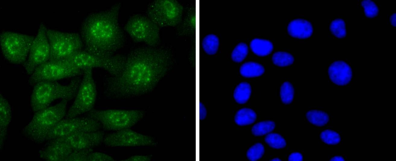 Anti-Caspase-14 Antibody (3A777)