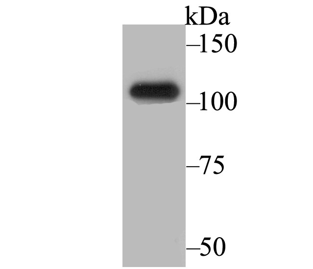 Anti-BRD2 Antibody (7Q375)
