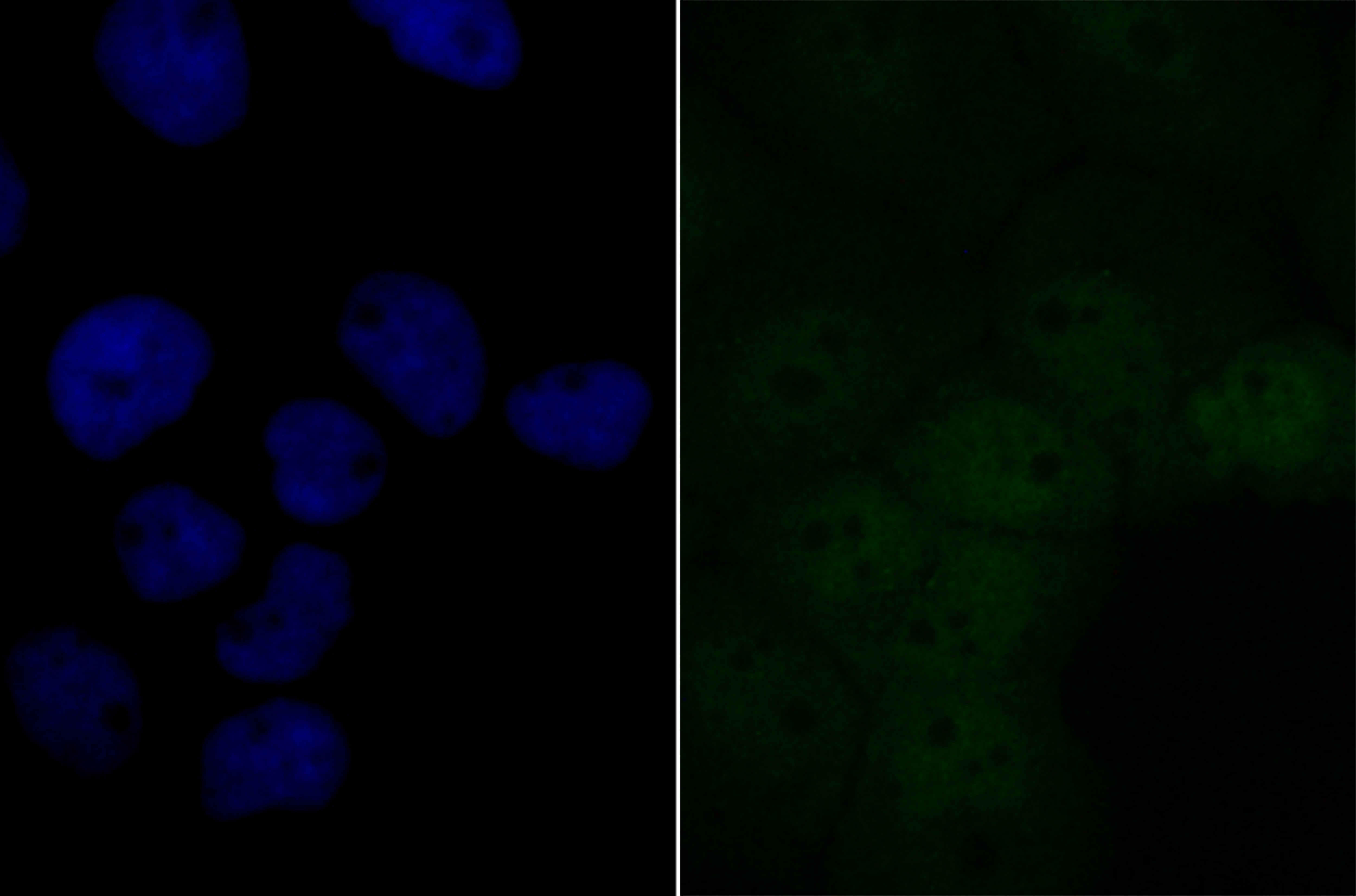 Anti-BRD2 Antibody (7Q375)