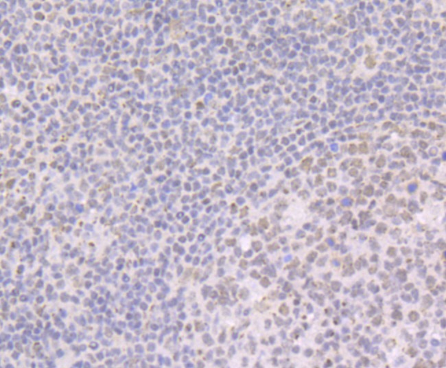 Anti-BRD2 Antibody (7Q375)