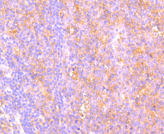 Anti-C14orf93 Antibody (8U54)