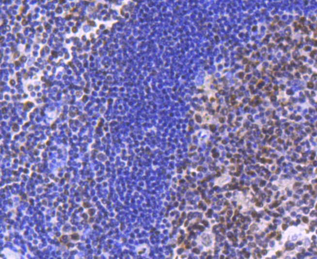 Anti-SMARCA4 Antibody (3I277)