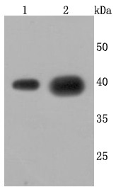 Anti-CTSL Antibody (9O318)