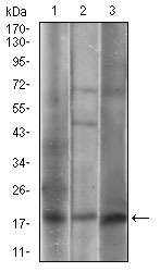 Anti-CAV2 Antibody (8Z468)