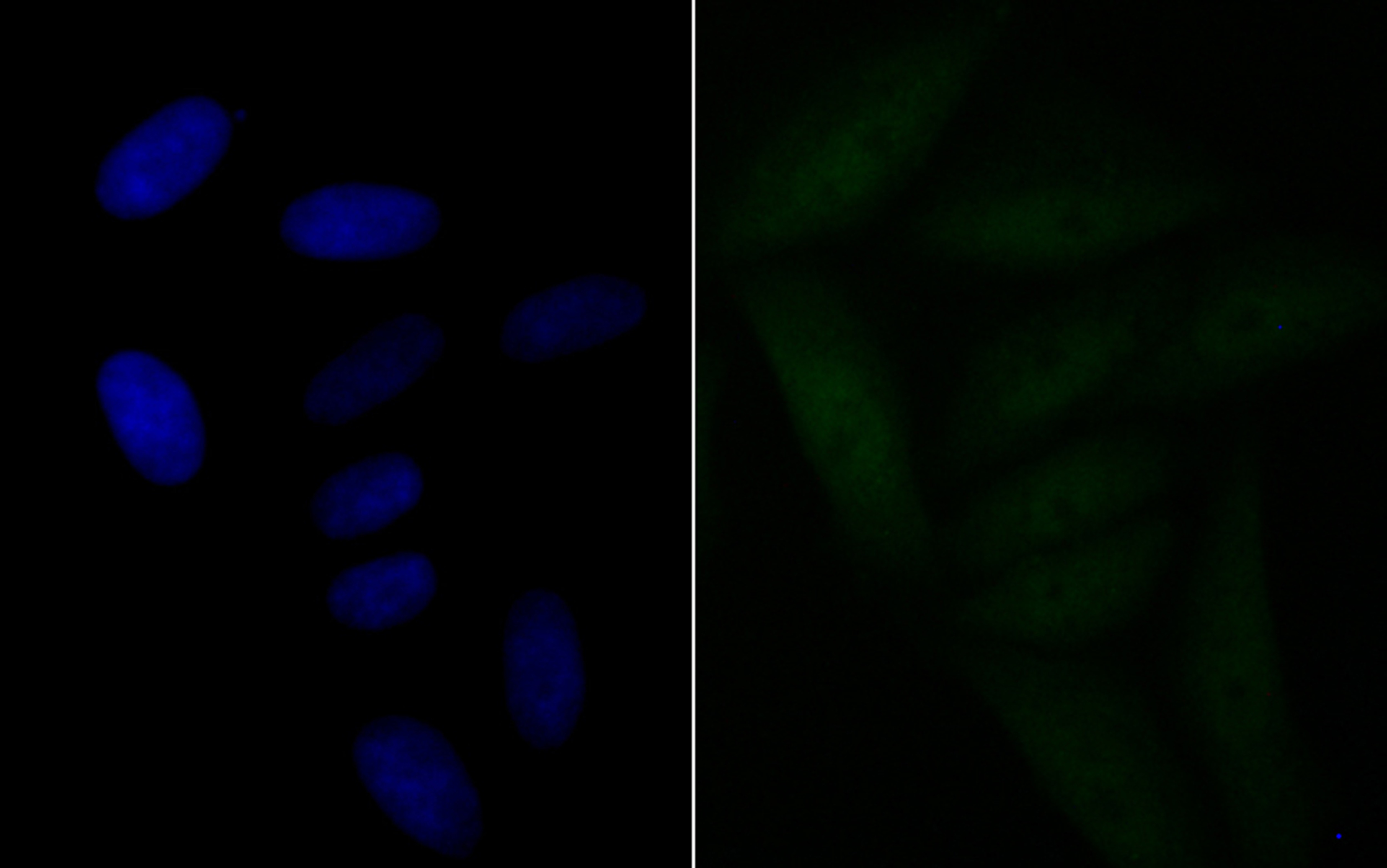 Anti-BRD2 Antibody (7Q375)