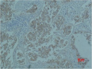 Anti-CTNNB1 Antibody (2B924)