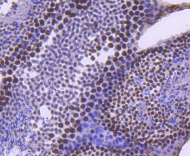 Anti-SMARCA4 Antibody (3I277)