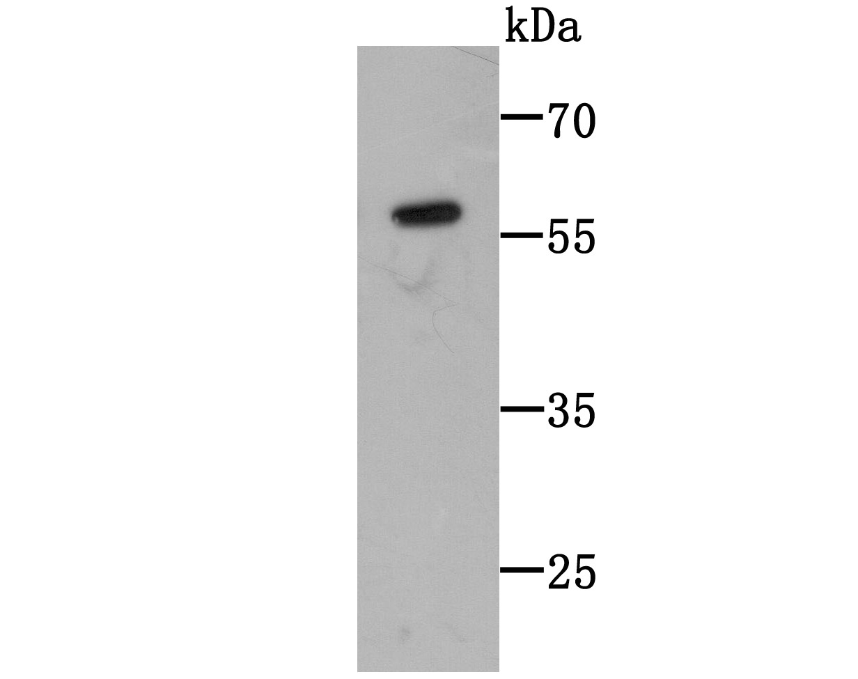Anti-C14orf93 Antibody (8U54)